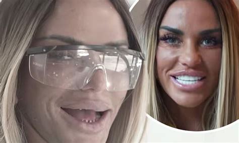 Katie Price shows off her real teeth ahead of getting new veneers。